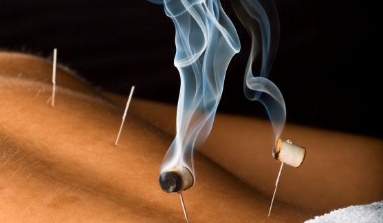 Premium Moxibustion Products & Cupping Supplies Moxa & Cupping The Acupuncture Supply Co